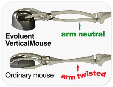 Evoluent Vertical Mouse Arm Haltung